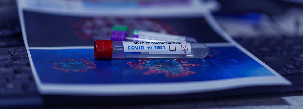 L'agence régionale de santé annonce une montée en puissance des dépistages du covid-19.