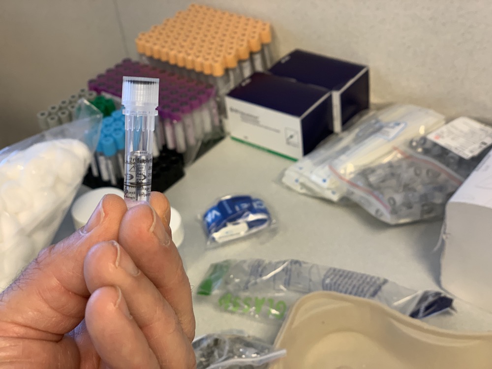 Dépistage du SARS-CoV-2, responsable de la covid-19. Les tests PCR (nasopharyngés).